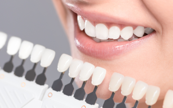 Teeth Whitening
